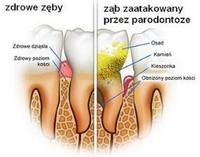 periodont